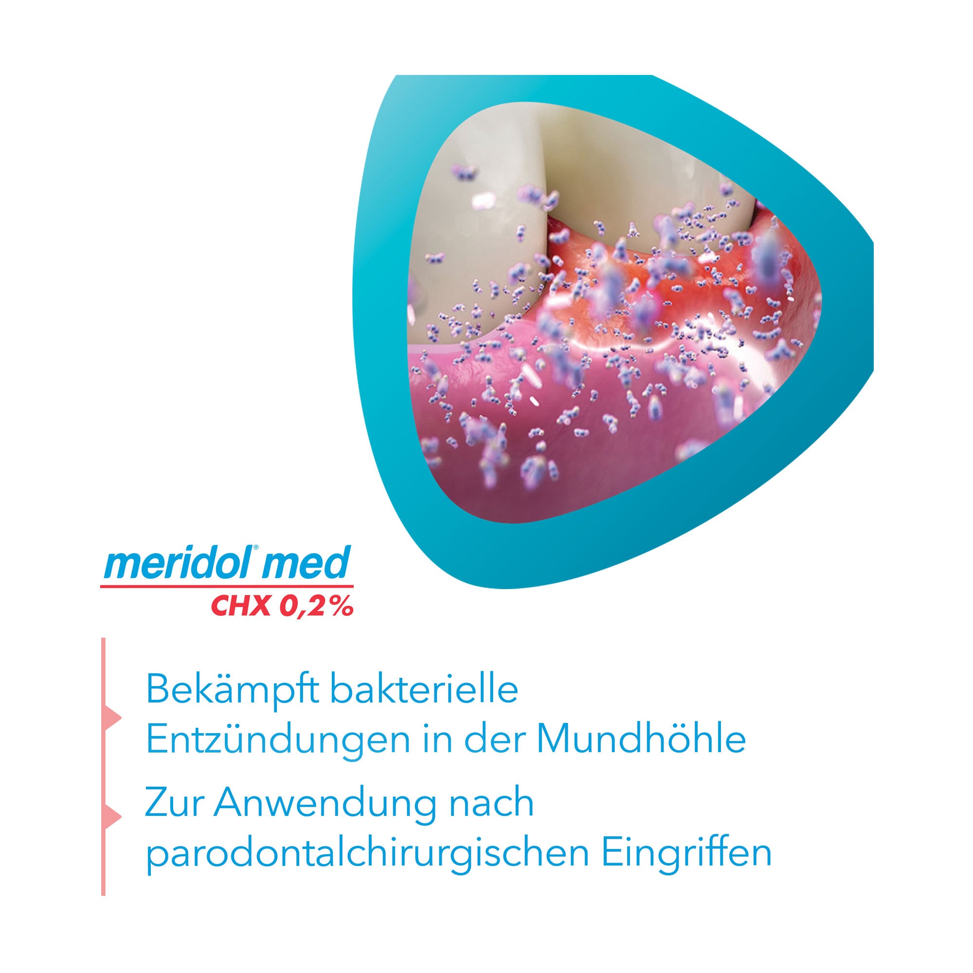 Grafik Meridol med CHX 0,2% Spülung Anwendungsgebiet