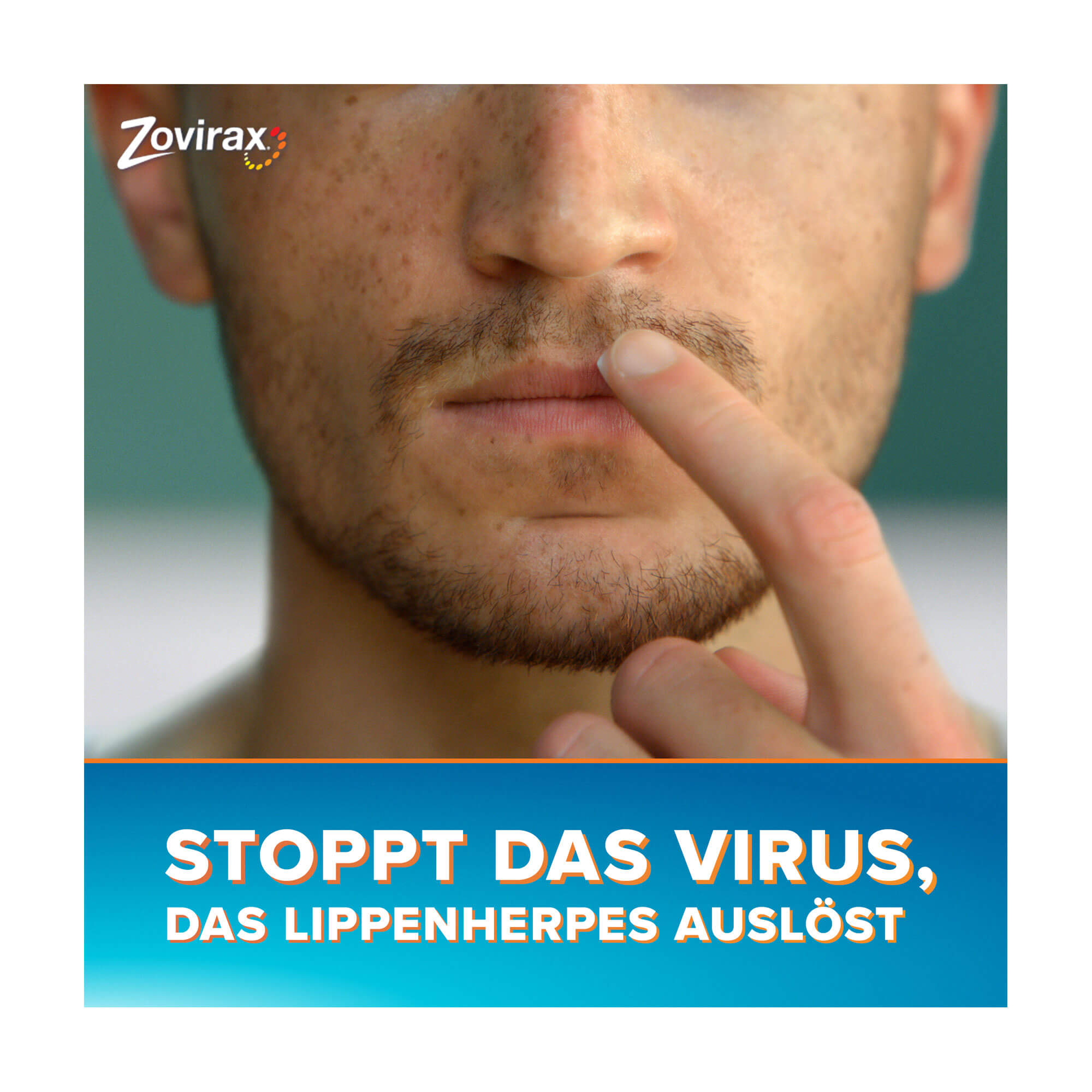 Grafik Zovirax Lippenherpescreme Stoppt das Virus, das Lippenherpes auslöst