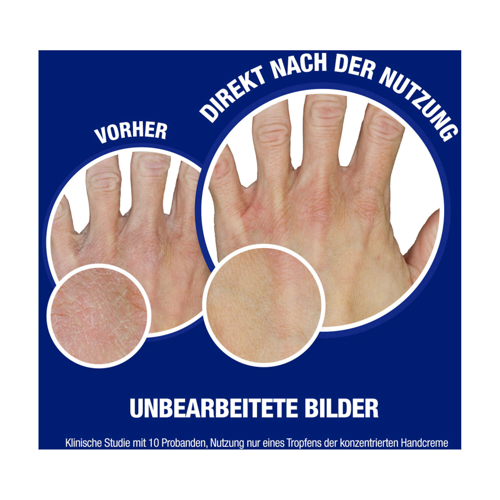 Grafik Neutrogena Norweg. Formel Sofort Einziehende Handcreme Vorher-Nachher-Vergleich