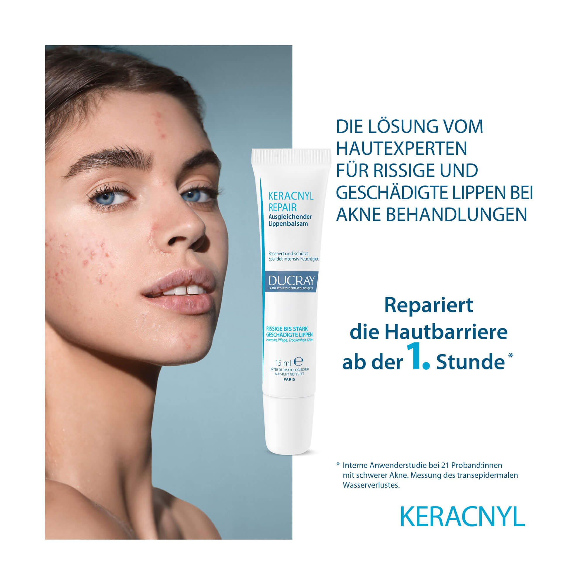 Grafik Ducray Keracnyl Repair Lippenbalsam Wirkung