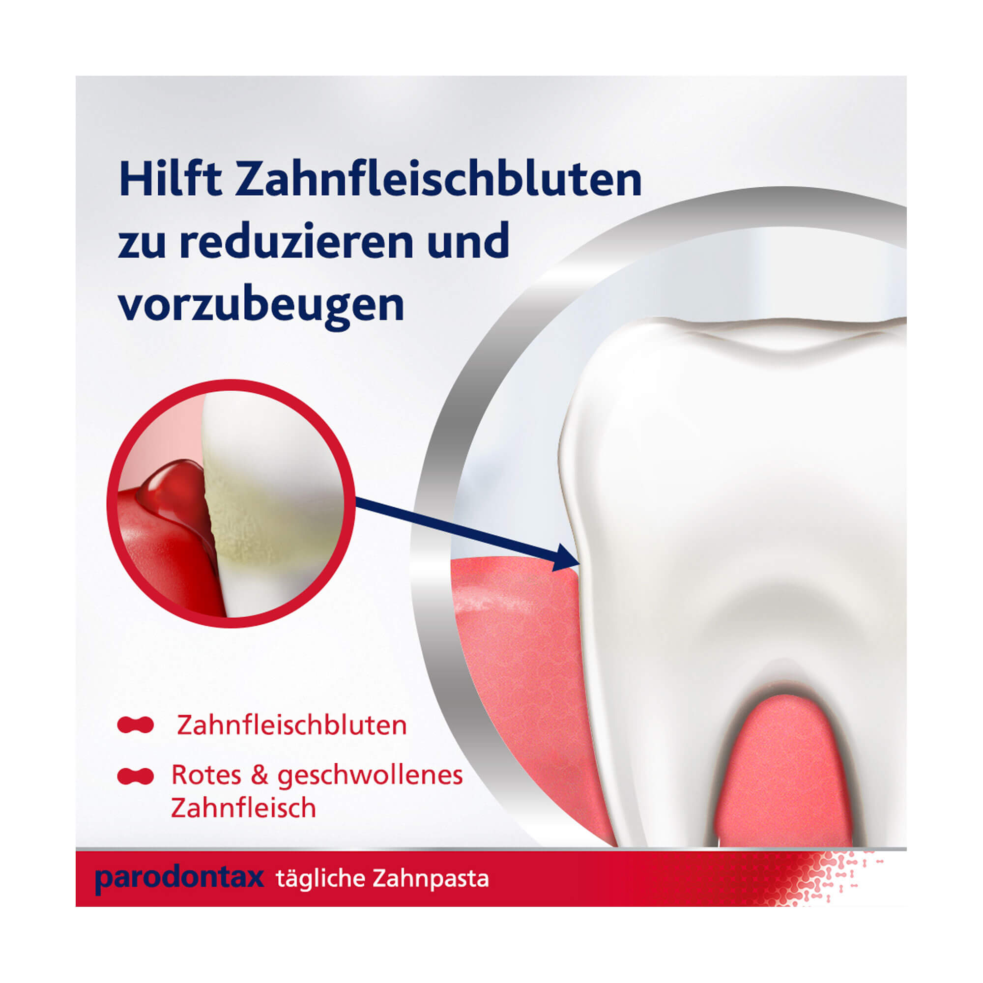 Grafik Parodontax Complete Protection Whitening Zahnpasta Hilft Zahnfleischbluten zu reduzieren und vorzubeugen