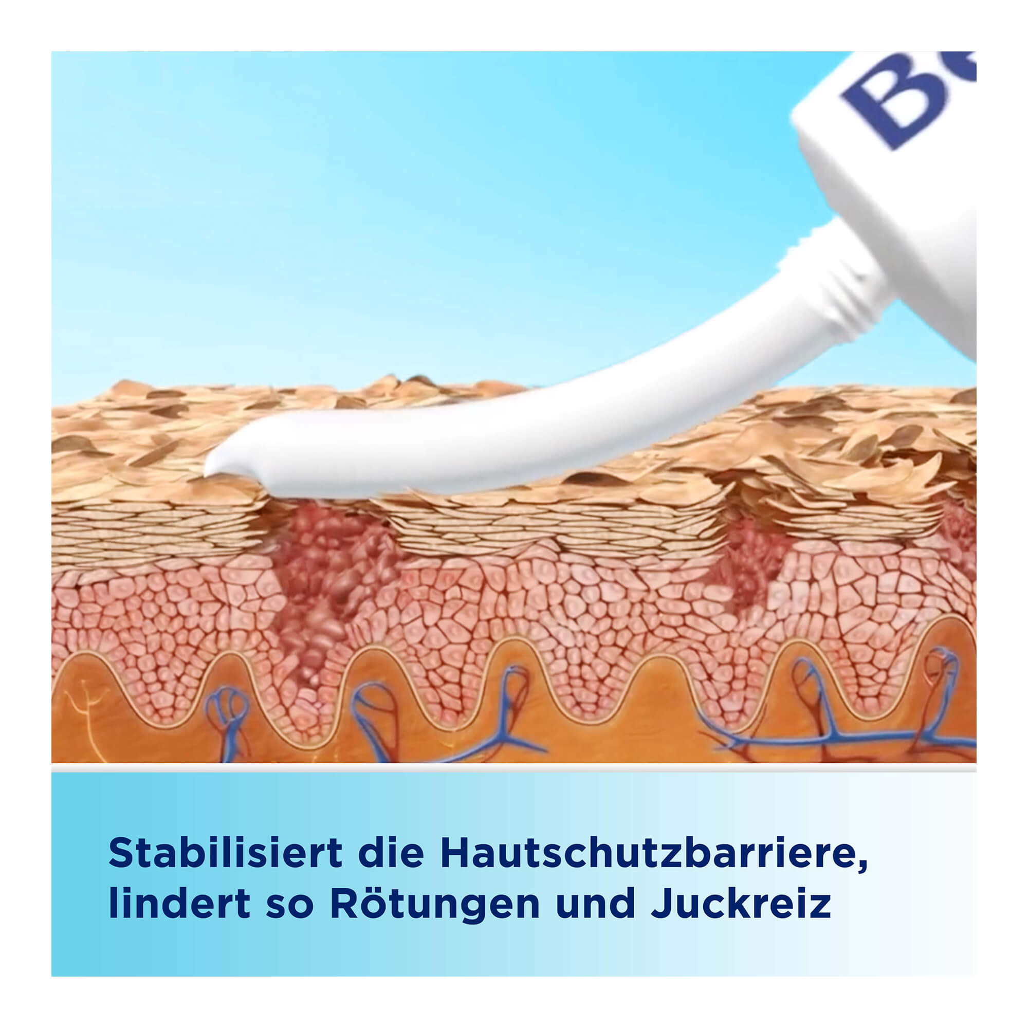 Grafik Bepanthen Sensiderm Creme Stabilisiert die Hautschutzbarriere, lindert so Rötungen und Juckreiz