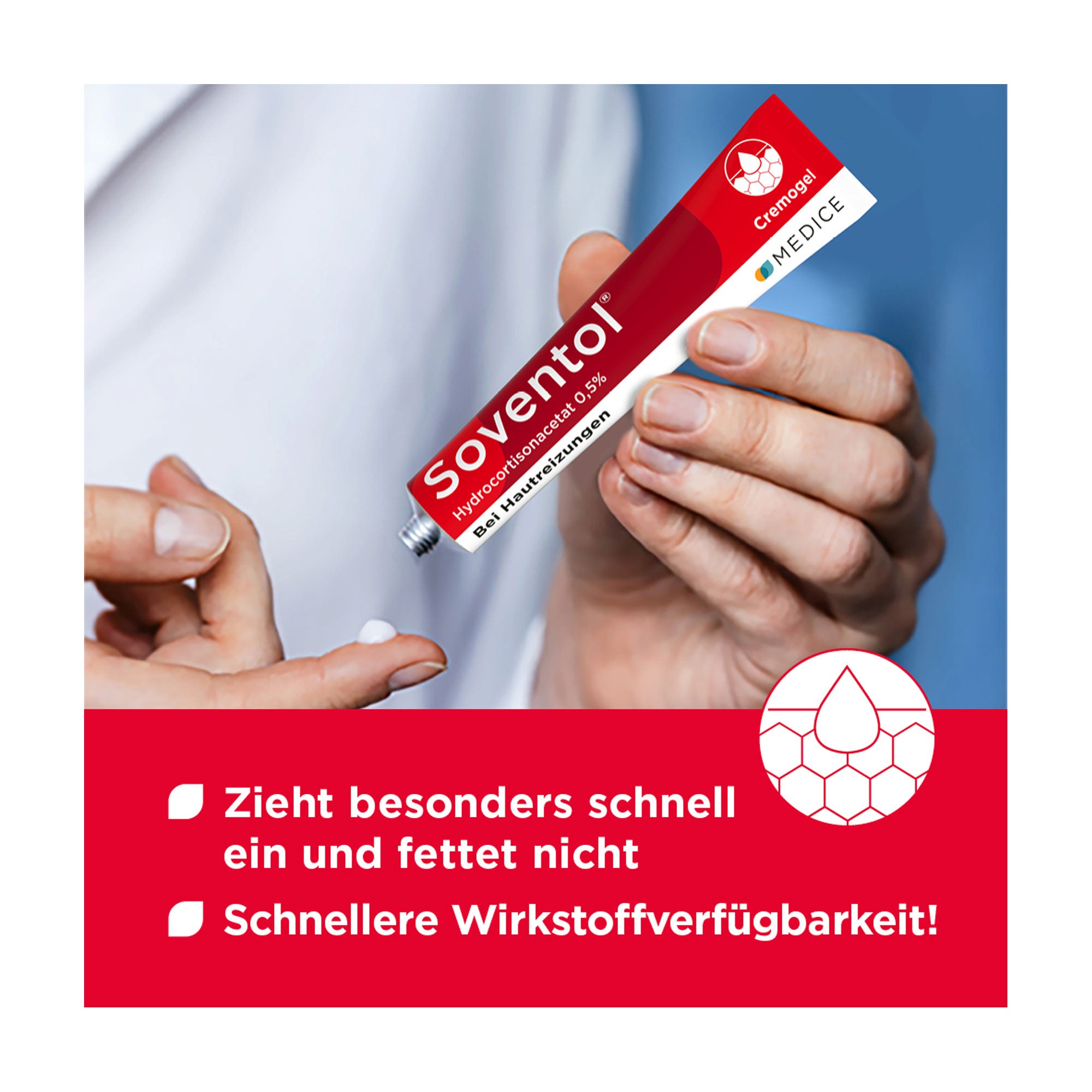 Grafik Soventol Hydrocortisonacetat 0,5 % Creme Zieht besonders schnell ein und fettet nicht